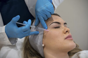 Tratamiento con Botox para reducir arrugas de expresión - Fotografía en PB Clinical